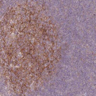 Immunohistochemistry-Paraffin: RFTN1 Antibody [NBP2-14655]