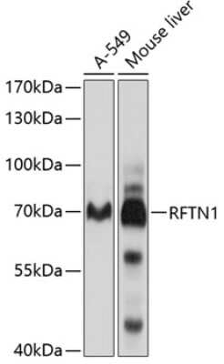 Western Blot: RFTN1 AntibodyBSA Free [NBP2-93491]