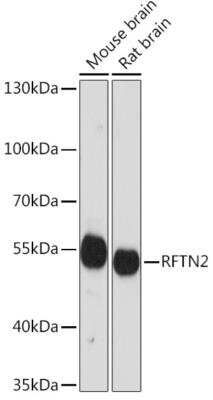 Western Blot: RFTN2 AntibodyAzide and BSA Free [NBP2-94334]