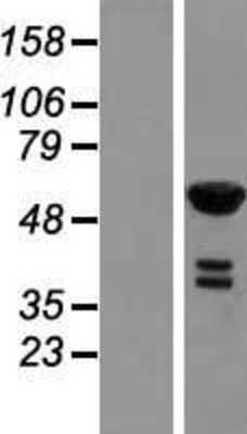 Western Blot: RFTN2 Overexpression Lysate [NBL1-15302]