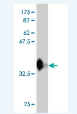 Western Blot: RFWD3 Antibody (6B4) [H00055159-M01]