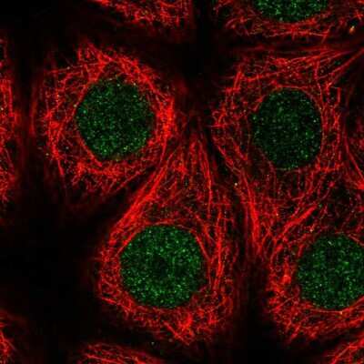 Immunocytochemistry/ Immunofluorescence: RFWD3 Antibody [NBP2-57566]