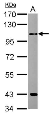 Western Blot: RFWD3 Antibody [NBP2-20141]