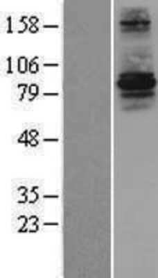 Western Blot: RFWD3 Overexpression Lysate [NBL1-15303]