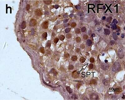 Immunohistochemistry: RFX1 Antibody [NBP1-52654]