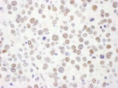 Immunohistochemistry-Paraffin: RFX1 Antibody [NBP1-52654]