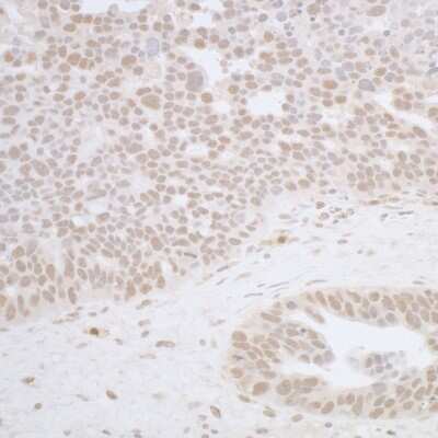 Immunohistochemistry-Paraffin: RFX1 Antibody [NBP1-52654]