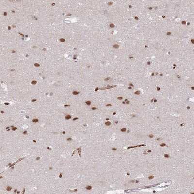 Immunohistochemistry-Paraffin: RFX1 Antibody [NBP2-13223]