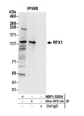 Immunoprecipitation: RFX1 Antibody [NBP1-52654]