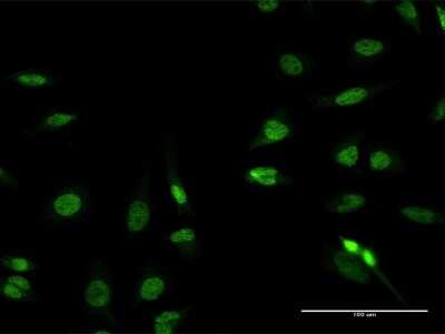 Immunocytochemistry/ Immunofluorescence: RFX2 Antibody [H00005990-B01P]