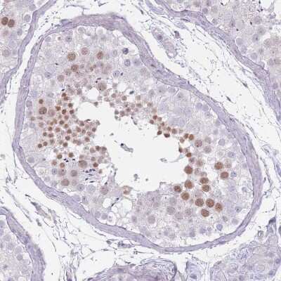 Immunohistochemistry-Paraffin: RFX2 Antibody [NBP2-13224]