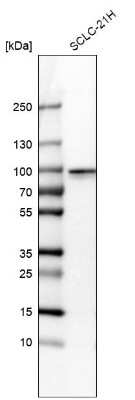 Western Blot: RFX2 Antibody [NBP2-13224]