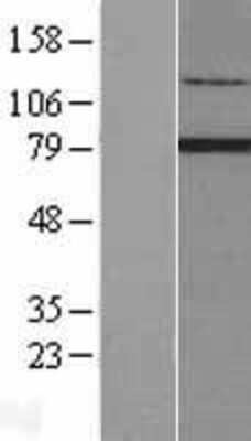 Western Blot: RFX2 Overexpression Lysate [NBL1-15305]