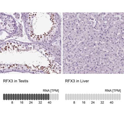 Immunohistochemistry-Paraffin: RFX3 Antibody [NBP1-86301]