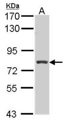 Western Blot: RFX3 Antibody [NBP1-31658]