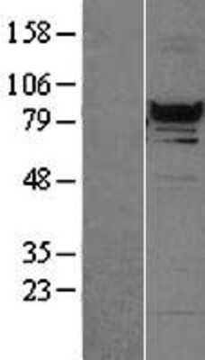 Western Blot: RFX3 Overexpression Lysate [NBL1-15306]