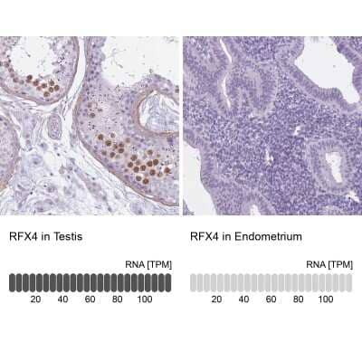 Immunohistochemistry-Paraffin: RFX4 Antibody [NBP2-48967]