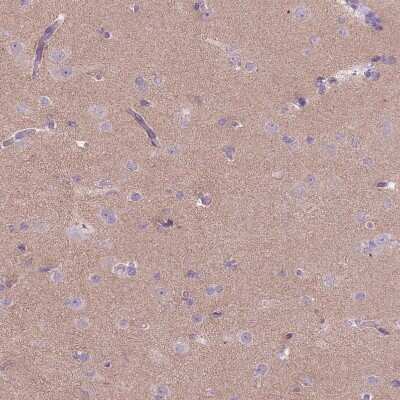 Immunohistochemistry-Paraffin: RFX4 Antibody [NBP2-48967]