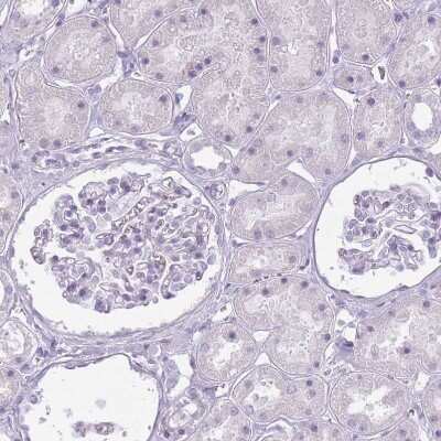 Immunohistochemistry-Paraffin: RFX4 Antibody [NBP2-48967]