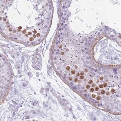 Immunohistochemistry-Paraffin: RFX4 Antibody [NBP2-48967]