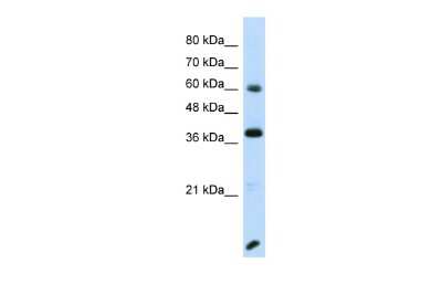 Western Blot: RFX4 Antibody [NBP2-88143]