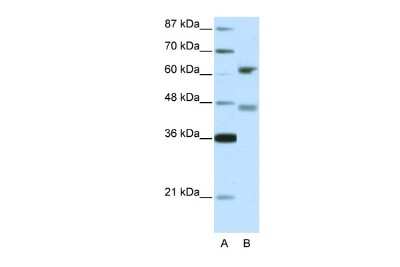 Western Blot: RFX4 Antibody [NBP2-88144]