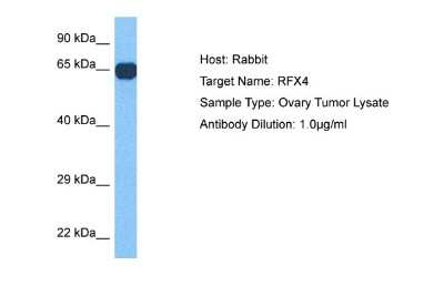 Western Blot: RFX4 Antibody [NBP2-88147]