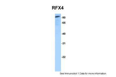 Western Blot: RFX4 Antibody [NBP2-88147]