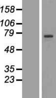 Western Blot: RFX4 Overexpression Lysate [NBL1-15307]