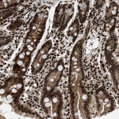 Immunohistochemistry-Paraffin: RFX5 Antibody [NBP1-86041]
