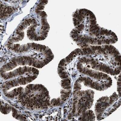 Immunohistochemistry-Paraffin: RFX5 Antibody [NBP1-86041]