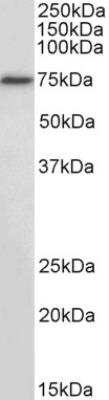 Western Blot: RFX5 Antibody [NBP2-26106]