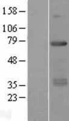 Western Blot: RFX5 Overexpression Lysate [NBP2-09176]