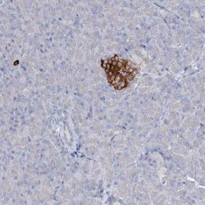 Immunohistochemistry-Paraffin: RFX6 Antibody [NBP2-48677]