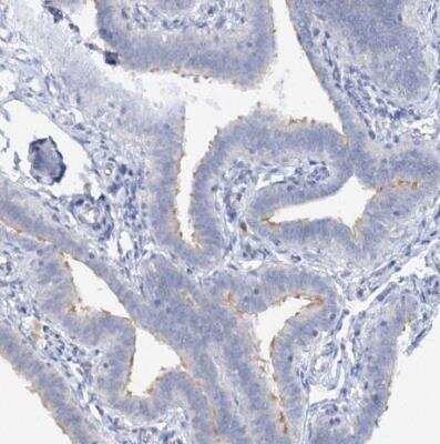 Immunohistochemistry-Paraffin: RFX6 Antibody [NBP2-48677]