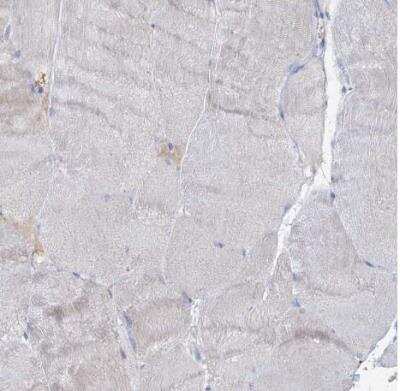 Immunohistochemistry-Paraffin: RFX6 Antibody [NBP2-48677]