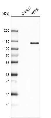 Western Blot: RFX6 Antibody [NBP2-48677]