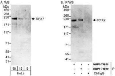 Western Blot: RFX7 Antibody [NBP1-71819]