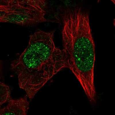 Immunocytochemistry/ Immunofluorescence: RFX8 Antibody [NBP2-58601]