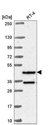 Western Blot: RFX8 Antibody [NBP2-58601]