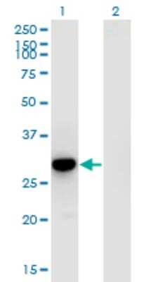 Western Blot: RFXANK Antibody (4G10) [H00008625-M01]