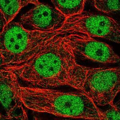 Immunocytochemistry/ Immunofluorescence: RFXANK Antibody [NBP2-13225]