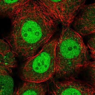 Immunocytochemistry/ Immunofluorescence: RFXANK Antibody [NBP2-58680]