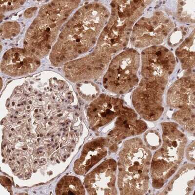 Immunohistochemistry-Paraffin: RFXANK Antibody [NBP2-13225]