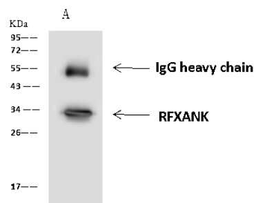 Immunoprecipitation: RFXANK Antibody [NBP2-97640]