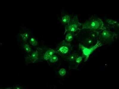 Immunocytochemistry/ Immunofluorescence: RFXANK Antibody (OTI3B4) - Azide and BSA Free [NBP2-73868]