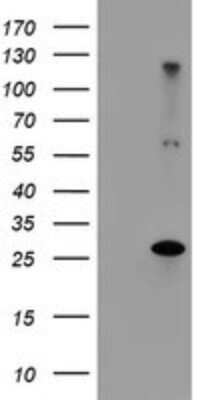 Western Blot: RFXANK Antibody (OTI3B4)Azide and BSA Free [NBP2-73868]