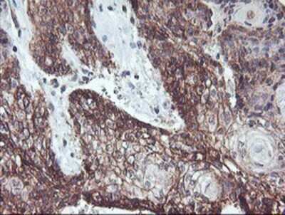 Immunohistochemistry: RFXANK Antibody (OTI3E7) - Azide and BSA Free [NBP2-73870]