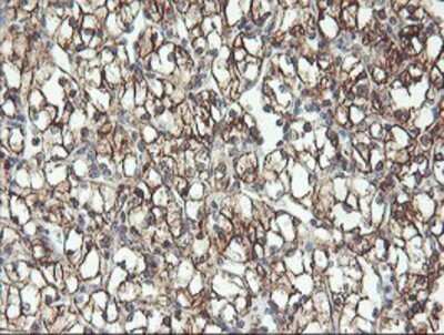 Immunohistochemistry: RFXANK Antibody (OTI3E7) - Azide and BSA Free [NBP2-73870]