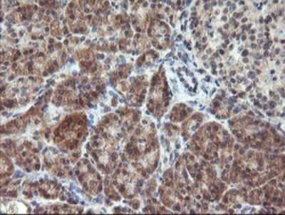 Immunohistochemistry: RFXANK Antibody (OTI3E7) - Azide and BSA Free [NBP2-73870]